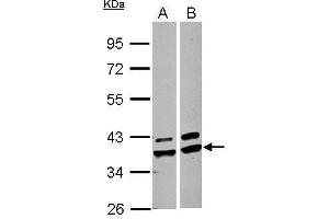 WB Image Sample (30 ug of whole cell lysate) A: A549 B: HepG2 10% SDS PAGE antibody diluted at 1:1000 (AKR1A1 抗体)