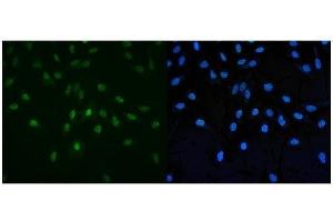IF analysis of PAF1 using anti-PAF1 antibody (ABIN7600333).