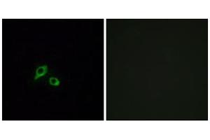 Immunofluorescence analysis of MCF-7 cells, using GIPR antibody. (GIPR 抗体  (Internal Region))