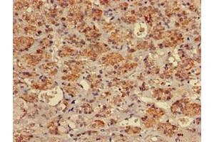 Immunohistochemistry of paraffin-embedded human adrenal gland tissue using ABIN7174961 at dilution of 1:100 (Myosin VIIA 抗体  (AA 838-968))