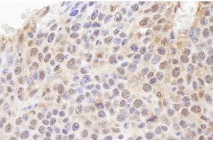 Immunohistochemistry (IHC) image for anti-Ubiquitin (Ub) (AA 1-50) antibody (ABIN7448849)