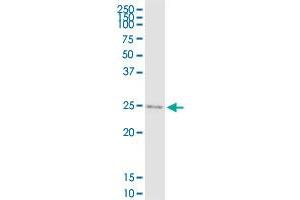 IGF2 MaxPab rabbit polyclonal antibody. (IGF2 抗体  (AA 1-180))