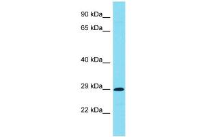 Host: Rabbit Target Name: C7orf57 Sample Type: Jurkat Whole Cell lysates Antibody Dilution: 1. (C7ORF57 抗体  (C-Term))