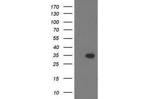 Image no. 1 for anti-CTD (Carboxy-terminal Domain, RNA Polymerase II, Polypeptide A) Small Phosphatase 1 (CTDSP1) antibody (ABIN1497677) (CTDSP1 抗体)