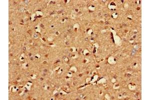 Immunohistochemistry of paraffin-embedded human brain tissue using ABIN7154332 at dilution of 1:100 (BLZF1 抗体  (AA 11-99))