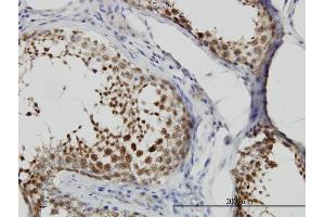 Immunoperoxidase of monoclonal antibody to CSE1L on formalin-fixed paraffin-embedded human testis. (Exportin 2 抗体  (AA 872-971))