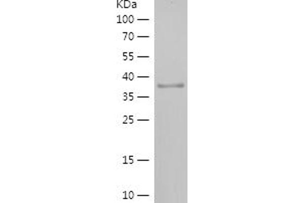 RPP21 Protein (AA 96-154) (His-IF2DI Tag)