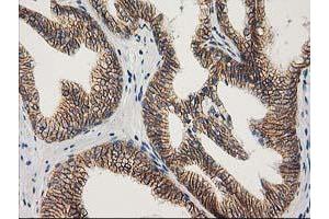 Image no. 2 for anti-Catenin (Cadherin-Associated Protein), beta 1, 88kDa (CTNNB1) antibody (ABIN1496888) (CTNNB1 抗体)