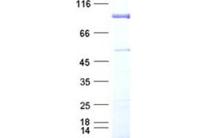 Western Blotting (WB) image for K(lysine) Acetyltransferase 2B (KAT2B) protein (DYKDDDDK Tag) (ABIN2728344)
