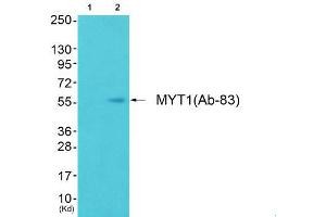 Western Blotting (WB) image for anti-Myelin Transcription Factor 1 (MYT1) (Ser83) antibody (ABIN1848242) (MYT1 抗体  (Ser83))