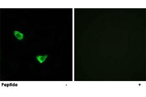Immunofluorescence analysis of MCF-7 cells, using CHPF polyclonal antibody . (CHPF 抗体)