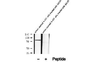 Western blot analysis of extracts of serum-starved A-431 cells treated with (hEGF), using Phospho-DR6 (Ser562) Antibody.
