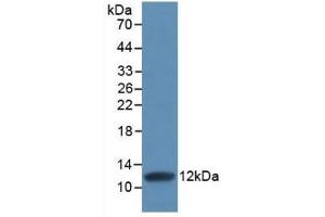 Detection of Recombinant IL8, Human using Monoclonal Antibody to Interleukin 8 (IL8) (IL-8 抗体  (AA 28-99))