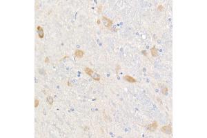 Immunohistochemistry (IHC) image for anti-Acyl-CoA Synthetase Long-Chain Family Member 4 (ACSL4) antibody (ABIN7265424)