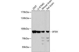 Western blot analysis of extracts of various cell lines using IFT81 Polyclonal Antibody at dilution of 1:3000. (IFT81 抗体)