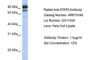 Western Blotting (WB) image for anti-Signal Transducer and Activator of Transcription 6, Interleukin-4 Induced (STAT6) (C-Term) antibody (ABIN2777200)