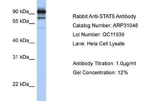 WB Suggested Anti-STAT6 Antibody Titration:  1 ug/ml  Positive Control:  Hela cell lysate STAT6 is strongly supported by BioGPS gene expression data to be expressed in Human HeLa cells