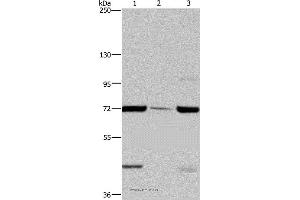 Western blot analysis of LoVo cell, human testis tissue and A549 cell, using FAAH Polyclonal Antibody at dilution of 1:400 (FAAH 抗体)