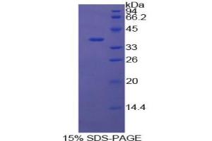 SDS-PAGE analysis of Cow Annexin V Protein. (Annexin V 蛋白)