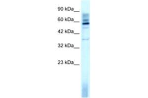 Western Blotting (WB) image for anti-TAF15 RNA Polymerase II, TATA Box Binding Protein (TBP)-Associated Factor, 68kDa (TAF15) antibody (ABIN2460174) (TAF15 抗体)