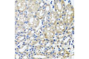 Immunohistochemistry of paraffin-embedded mouse kidney using ST8SIA2 antibody. (ST8SIA2 抗体  (AA 24-160))