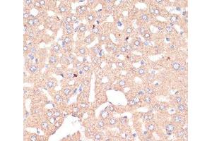 Immunohistochemistry (Paraffin-embedded Sections) (IHC (p)) image for anti-ATP Synthase, H+ Transporting, Mitochondrial F1 Complex, alpha Subunit 1, Cardiac Muscle (ATP5A1) antibody (ABIN7010884)