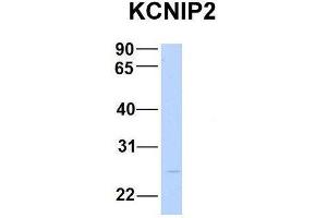 Host:  Rabbit  Target Name:  KCNIP2  Sample Type:  Human Fetal Brain  Antibody Dilution:  1. (KCNIP2 抗体  (N-Term))