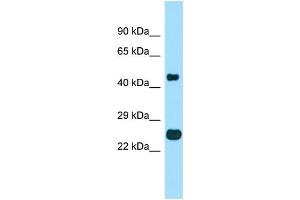 WB Suggested Anti-TMBIM4 Antibody Titration: 1.