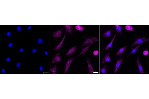 Immunocytochemical staining of C2C12 cells with Argonaute RISC catalytic component 2 antibody (ABIN7797650), 1:1,000). (Recombinant AGO2 抗体)