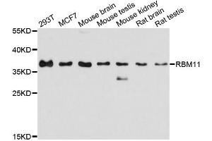 Western blot analysis of extracts of various cell lines, using RBM11 antibody. (RBM11 抗体)