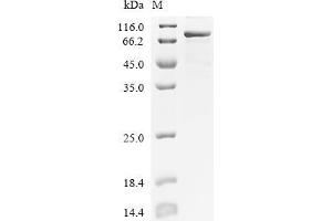 Spleen tyrosine Kinase (SYK) (AA 1-635), (full length) protein (His tag)