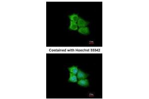 ICC/IF Image Immunofluorescence analysis of methanol-fixed A431, using PCMT1, antibody at 1:200 dilution. (PCMT1 抗体)