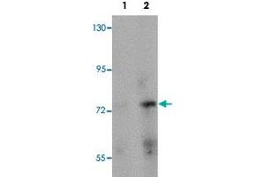 Western blot analysis of rat brain tissue with PIAS2 polyclonal antibody  at (Lane 1) 1 and (Lane 2) 2 ug/mL dilution. (PIAS2 抗体  (N-Term))