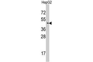 Western blot analysis of SNX6 polyclonal antibody  in HepG2 cell line lysates (35 ug/lane). (SNX6 抗体  (N-Term))