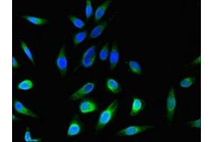 Immunofluorescent analysis of Hela cells using ABIN7174788 at dilution of 1:100 and Alexa Fluor 488-congugated AffiniPure Goat Anti-Rabbit IgG(H+L) (C1ORF189 抗体  (AA 1-101))