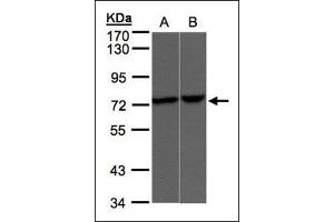 Western Blotting (WB) image for anti-Transient Receptor Potential Cation Channel, Subfamily V, Member 2 (TRPV2) (Ser157) antibody (ABIN615540)