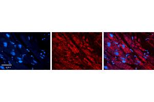 Rabbit Anti-DBI Antibody   Formalin Fixed Paraffin Embedded Tissue: Human heart Tissue Observed Staining: Cytoplasmic Primary Antibody Concentration: 1:100 Other Working Concentrations: 1:600 Secondary Antibody: Donkey anti-Rabbit-Cy3 Secondary Antibody Concentration: 1:200 Magnification: 20X Exposure Time: 0. (Diazepam Binding Inhibitor 抗体  (N-Term))