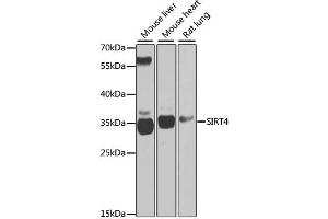 Western blot analysis of extracts of various cell lines, using SIRT4 antibody (ABIN2559931) at 1:1000 dilution. (SIRT4 抗体)