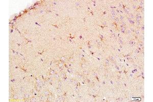 Immunohistochemistry (Paraffin-embedded Sections) (IHC (p)) image for anti-Solute Carrier Family 1 (Glial High Affinity Glutamate Transporter), Member 3 (SLC1A3) (AA 301-400) antibody (ABIN730783)