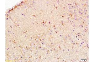 Formalin-fixed and paraffin embedded: rat brain tissue labeled with Anti-EAAT1/GLAST Polyclonal Antibody , Unconjugated at 1:200, followed by conjugation to the secondary antibody and DAB staining