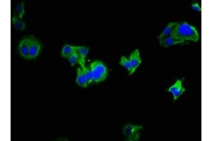 Immunofluorescence staining of HepG2 cells with ABIN7158146 at 1:333, counter-stained with DAPI. (LRRC19 抗体  (AA 25-270))