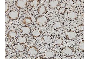 Immunoperoxidase of monoclonal antibody to QARS on formalin-fixed paraffin-embedded human colon. (QARS 抗体  (AA 677-775))