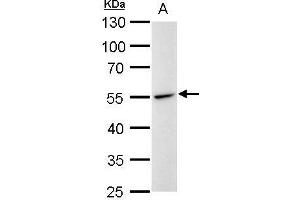 WB Image Desmin antibody detects Desmin protein by western blot analysis. (Desmin 抗体)