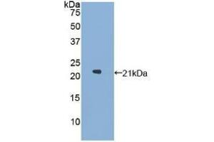 WB of Protein Standard: different control antibodies against Highly purified E. (GAA ELISA 试剂盒)