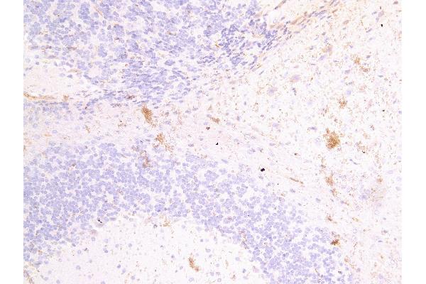 Fascin 2 抗体  (Internal Region)