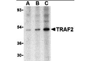 Western Blotting (WB) image for anti-TNF Receptor-Associated Factor 2 (TRAF2) (N-Term) antibody (ABIN1031639) (TRAF2 抗体  (N-Term))
