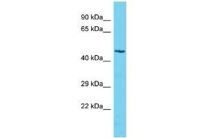 Host: Rabbit Target Name: C3orf32 Sample Type: Jurkat Whole Cell lysates Antibody Dilution: 1. (SSUH2 抗体  (Middle Region))