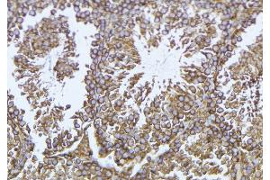 ABIN6276930 at 1/100 staining Mouse testis tissue by IHC-P. (GLB1 抗体  (Internal Region))