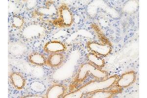 ABIN6256521 and ABIN6267628 at 1/100 staining human normal kidney tissue by IHC-P.