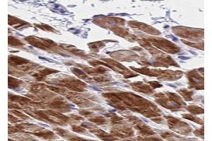 ABIN6266734 at 1/100 staining human skeletal muscle tissue sections by IHC-P. (Adenylate Kinase 1 抗体  (Internal Region))